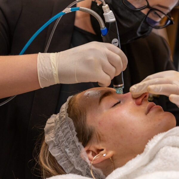 Подмладяване с Hydrafacial