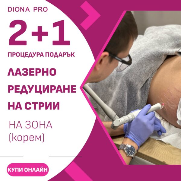 Лазерно редуциране на стрии на корем 2 процедури + 1 подарък