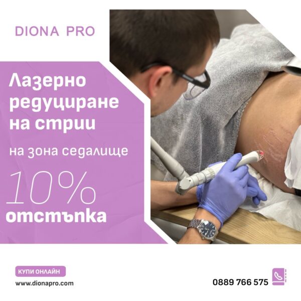 Лазерно редуциране на стрии на седалище с 10% отстъпка